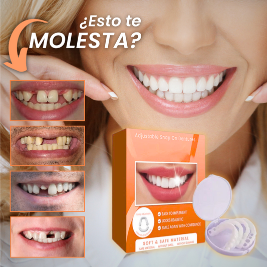 Carillas Dentales Snap-On Smile: Tu Sonrisa Perfecta en Segundos, Sin Dentista